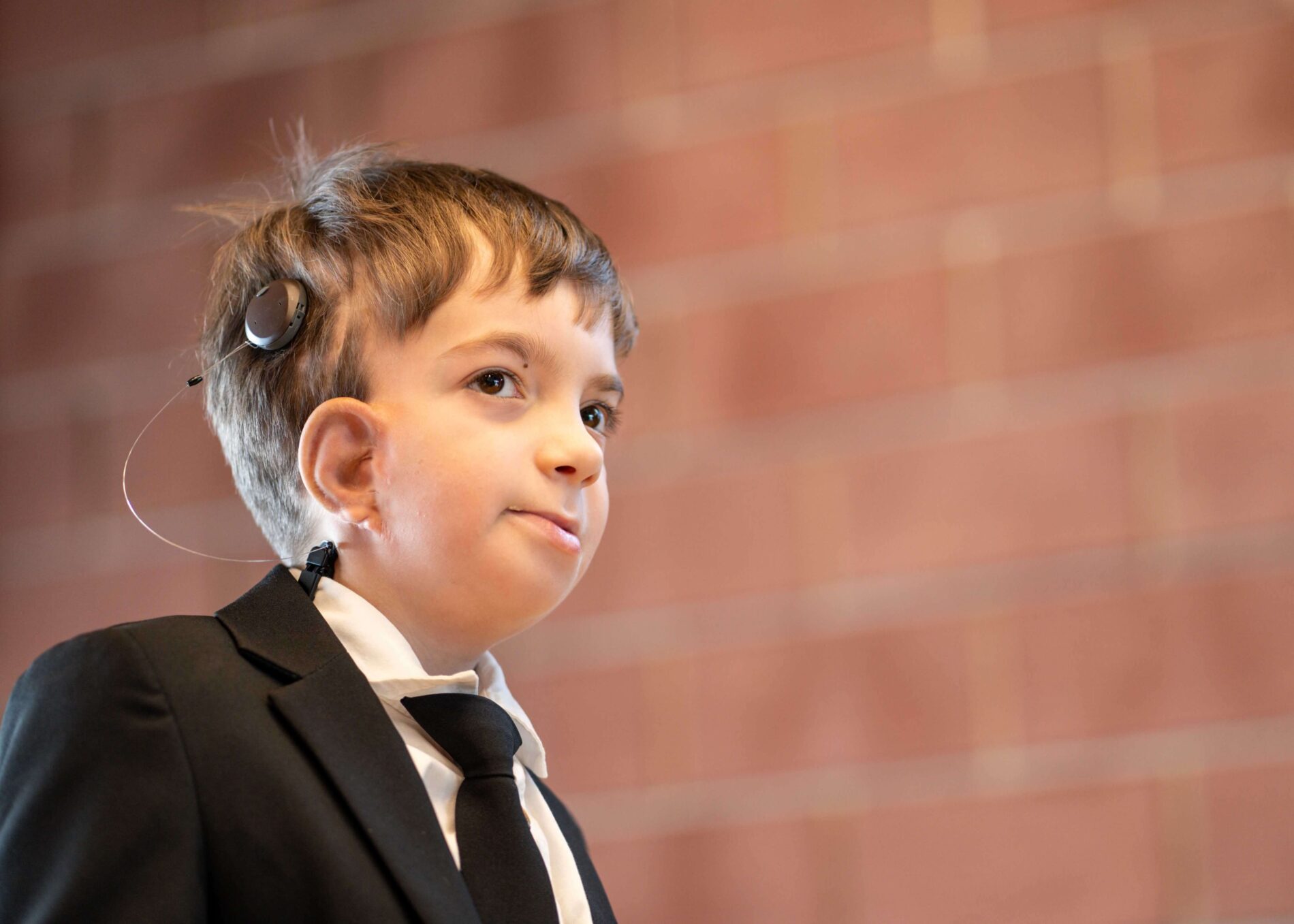 Microtia Czech Republic