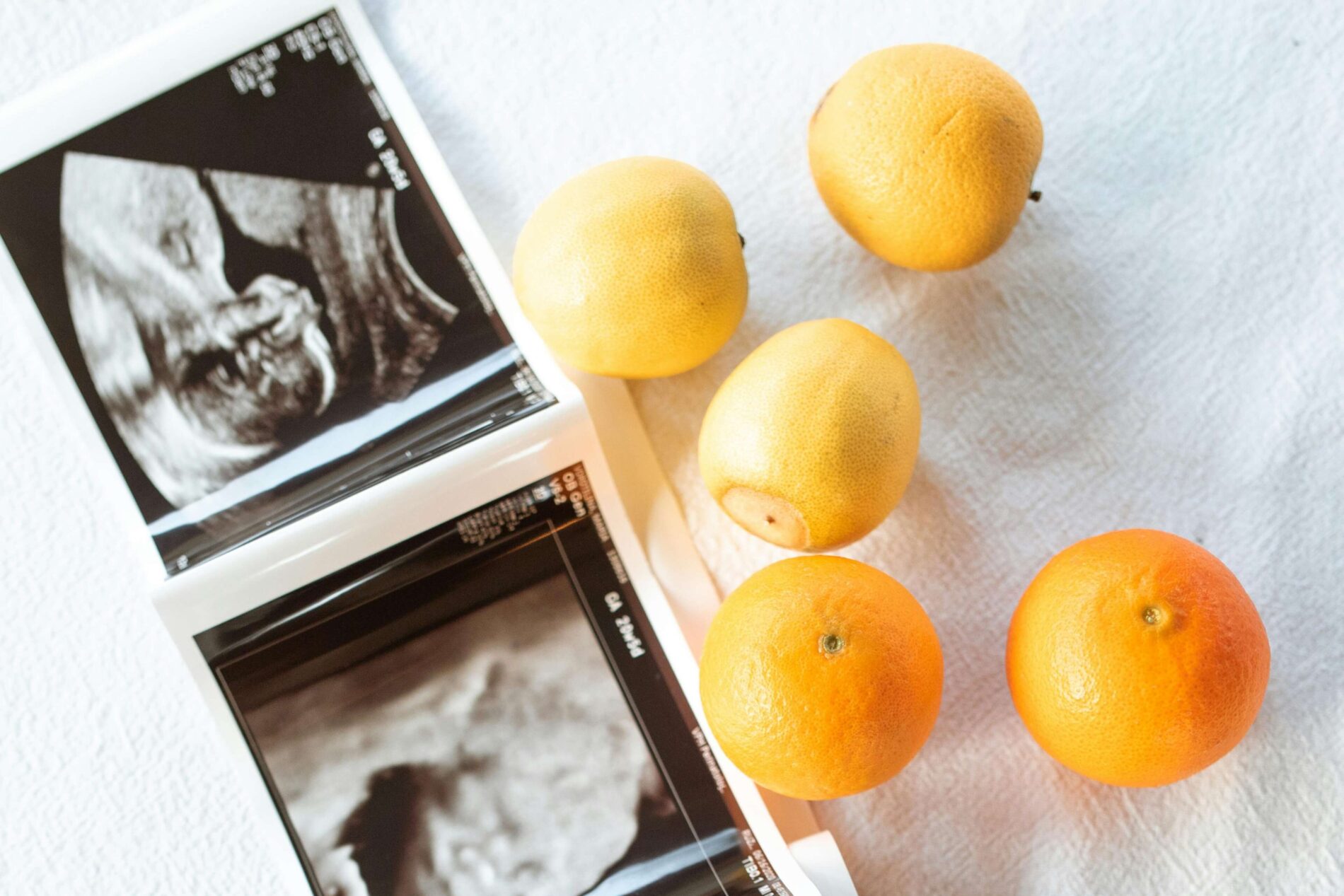 Těhotenský ultrazvuk